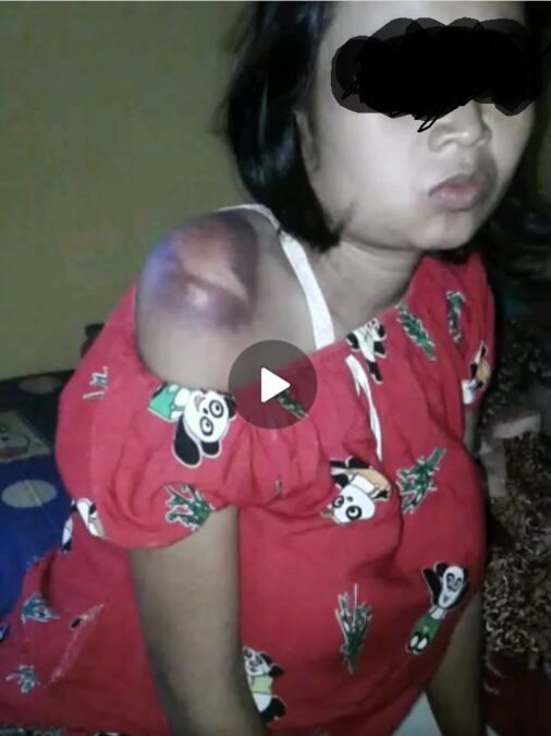 Gambar